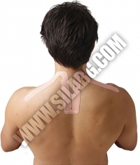 SPIDERTECH PRE-CUT NECK (GENTLE)